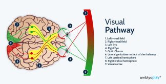 Visual_Pathway_AmblyoPlay_Vision_Therapy Visual Pathway
